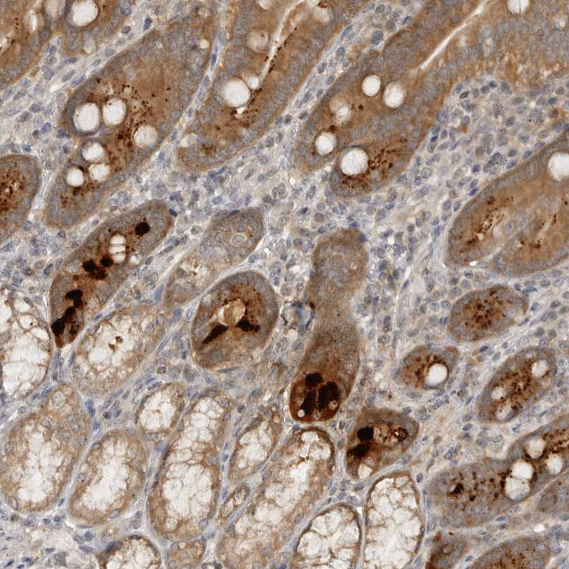 Anti-HTRA2 Antibody