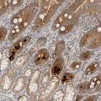 Anti-HTRA2 Antibody