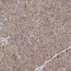Immunohistochemical staining of human pancreas shows moderate cytoplasmic positivity in exocrine glandular cells.