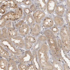 Immunohistochemical staining of human kidney shows moderate cytoplasmic positivity in cells in tubules.
