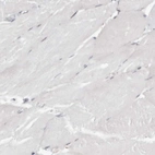 Immunohistochemical staining of human skeletal muscle shows no positivity in myocytes as expected.