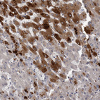 Anti-CRP Antibody