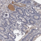 Immunohistochemical staining of human duodenum shows moderate positivity in plasma in blood vessels.