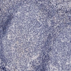Immunohistochemical staining of human tonsil shows no cytoplasmic positivity as expected.