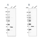 Anti-CRP Antibody