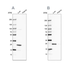Western blot analysis using Anti-CRP antibody HPA027367 (A) shows similar pattern to independent antibody HPA027396 (B).