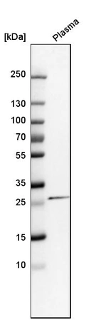 Western blot analysis in human plasma.