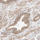 Anti-ALKAL1 Antibody