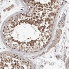 Immunohistochemical staining of human testis shows moderate to strong cytoplasmic positivity in cells in seminiferous ducts.