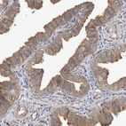 Immunohistochemical staining of human Fallopian tube shows moderate cytoplasmic positivity in glandular cells.