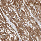 Anti-PDK1 Antibody