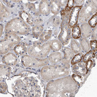 Anti-PDK1 Antibody