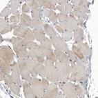 Immunohistochemical staining of human skeletal muscle shows weak cytoplasmic positivity in myocytes as expected.