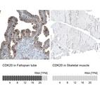 Anti-CDK20 Antibody