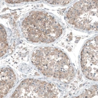 Immunohistochemical staining of human testis shows weak to moderate cytoplasmic positivity in cells in seminiferous ducts.