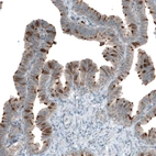 Immunohistochemical staining of human Fallopian tube shows weak to moderate cytoplasmic positivity in glandular cells.