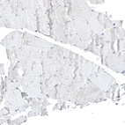 Immunohistochemical staining of human skeletal muscle shows no positivity in a subset of myocytes as expected.