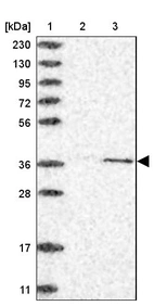 Lane 1: Marker [kDa] 230, 130, 95, 72, 56, 36, 28, 17, 11_br/_Lane 2: Human cell line RT-4_br/_Lane 3: Human cell line U-251MG sp