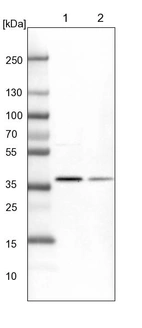 Lane 1: NIH-3T3 cell lysate (Mouse embryonic fibroblast cells)_br/_Lane 2: NBT-II cell lysate (Rat Wistar bladder tumour cells)