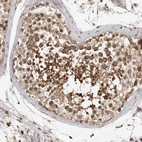 Immunohistochemical staining of human testis shows strong cytoplasmic positivity in cells in seminiferous ducts.