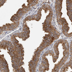 Immunohistochemical staining of human Fallopian tube shows moderate cytoplasmic positivity in glandular cells.