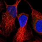 Immunofluorescent staining of human cell line U-2 OS shows localization to vesicles.