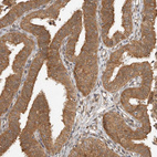 Immunohistochemical staining of human fallopian tube shows moderate cytoplasmic positivity in glandular cells.