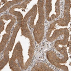 Immunohistochemical staining of human fallopian tube shows moderate cytoplasmic positivity in glandular cells.