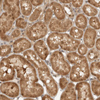Immunohistochemical staining of human kidney shows strong cytoplasmic and nuclear positivity in cells in tubules.