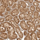 Immunohistochemical staining of human kidney shows strong cytoplasmic and nuclear positivity in cells in tubules.