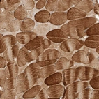 Immunohistochemical staining of human skeletal muscle shows strong cytoplasmic positivity in myocytes.