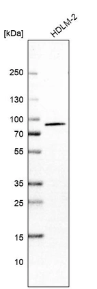 Western blot analysis in human cell line HDLM-2.
