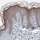 Immunohistochemical staining of human skin shows high expression.