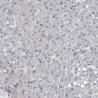 Immunohistochemical staining of human liver shows low expression as expected.