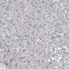 Immunohistochemical staining of human liver shows low expression as expected.