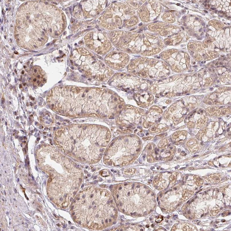 Anti-MMACHC Antibody