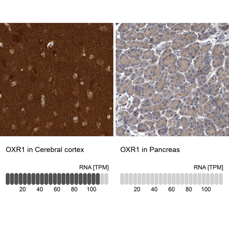 Anti-OXR1 Antibody