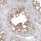Immunohistochemical staining of human testis shows moderate cytoplasmic positivity in cells in seminiferous ducts.