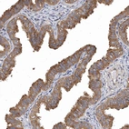 Immunohistochemical staining of human Fallopian tube shows moderate cytoplasmic positivity in glandular cells.
