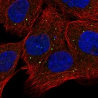 Immunofluorescent staining of human cell line A-431 shows positivity in vesicles.