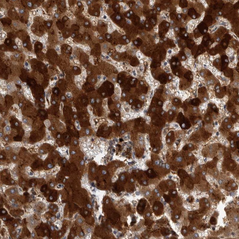 Anti-CRP Antibody