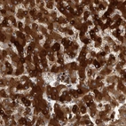Anti-CRP Antibody