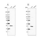 Western blot analysis using Anti-CRP antibody HPA027396 (A) shows similar pattern to independent antibody HPA027367 (B).