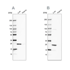 Western blot analysis using Anti-CRP antibody HPA027396 (A) shows similar pattern to independent antibody HPA027367 (B).