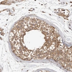 Immunohistochemical staining of human testis shows strong cytoplasmic positivity in cells in seminiferous ducts.