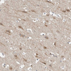 Immunohistochemical staining of human cerebral cortex shows moderate cytoplasmic positivity in neurons.