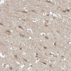 Immunohistochemical staining of human cerebral cortex shows moderate cytoplasmic positivity in neurons.