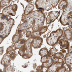 Immunohistochemical staining of human placenta shows strong cytoplasmic positivity in trophoblastic cells.
