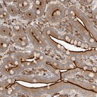 Anti-USH1C Antibody