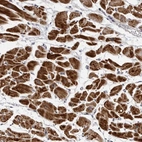 Anti-CDK20 Antibody